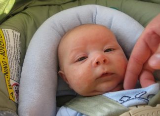 Principalele afectiuni dermatologice ale nou nascutului