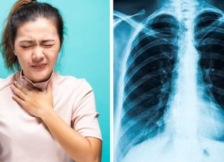 Alimente si corpi straini in plamani: cauze pentru care se poate intampla acest lucru